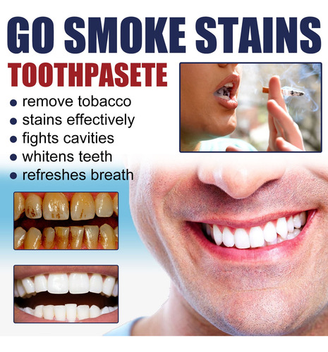 Pasta Dentífrica/gel Blanqueador Para Fumadores F Smokers 45
