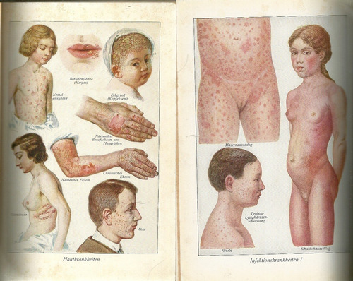 Antiguo Libro De Medicina Aleman De 1933 Dr Muller Recetario (Usado)