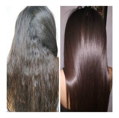 Cirugia Capilar Celulas Madres Litro K - L a $44000