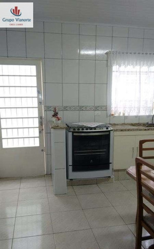 Imagem 4 de 15 de Casa A Venda No Bairro Tremembé Em São Paulo - Sp. - A-13421-1