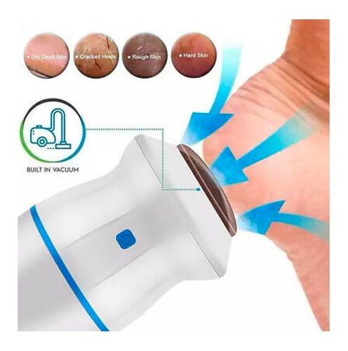 Imagen 6 de 10 de Lima Eléctrica Pedicure Vacuum Para Pies Removedor De Callos