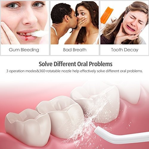 Mospro Irrigador Dental Inalambrico Profesional Portatil