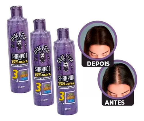 3 Shampoo Nixidil Fortificante 3 Em 1 - Dom Pelo 250ml