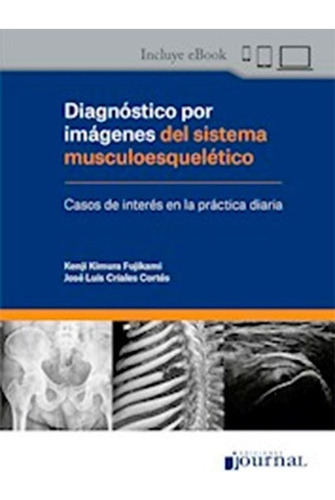 Diagnóstico Imágenes Sistema Musculoesqueletico Casos Kimura