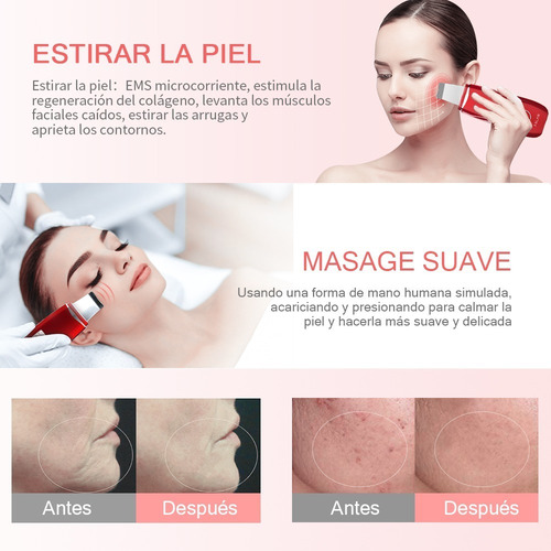 Dispositivo Ultrasónico Exfoliante Extractor De Espinillas