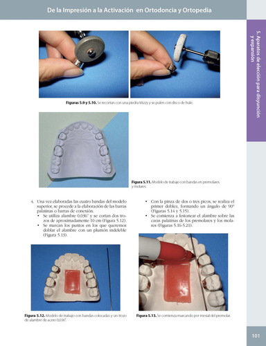De La Impresión A La Activación En Ortodoncia Y Ortopedia. 2ª Edición. Incluye E-book, De Esequiel Rodríguez., Vol. 1. Editorial Amolca, Tapa Dura, Edición 2 En Español, 2024