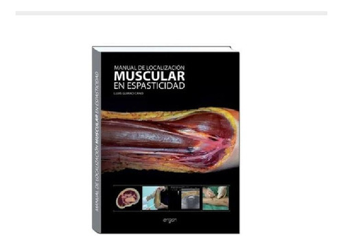 Libro - Manual De Localización Muscular En Espasticidad