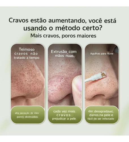 Lanbena Tiras De Poros 30gr 60 Tiras De Nariz Com Removedor Todo Tipo De Pele