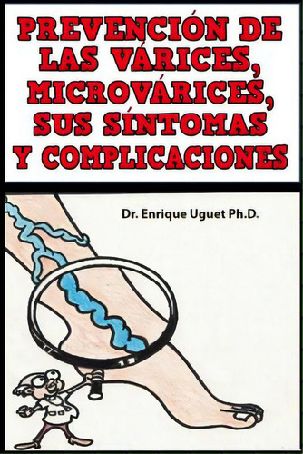 Prevencion De Las Varices, Microvarices, Sus Sintomas Y Complicaciones: (b & W), De Uguet Ph. D., Enrique. Editorial Createspace, Tapa Blanda En Español