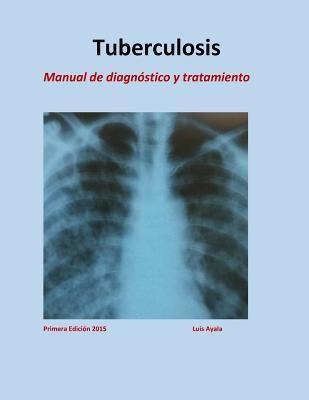 Libro Tratamiento De Tuberculosis : Manual De Diagn Stico...