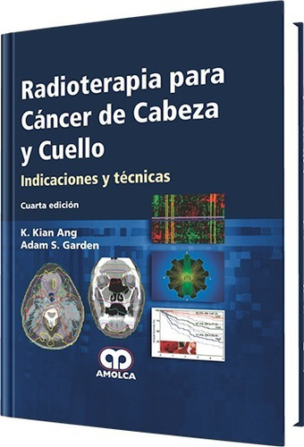 Radioterapia Para Cáncer De Cabeza Y Cuello 4ta Ed.