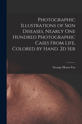 Libro Photographic Illustrations Of Skin Diseases, Nearly...