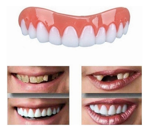 Paquete De 2 Dientes Falsos Profesionales De Silicona Bright