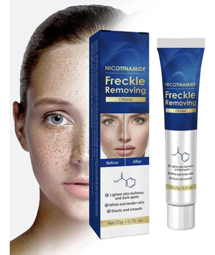 Eliminador Total Manchas Faciales, Pecas, Melasma Y Otros