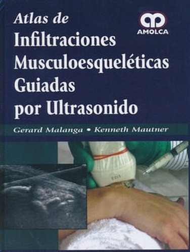 Atlas De Infiltraciones Musculoesquelétias Guiadas Malanga