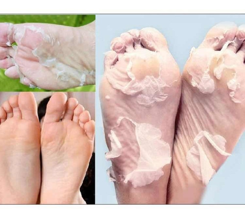 Eliminador De Callos Peeling Para Pies