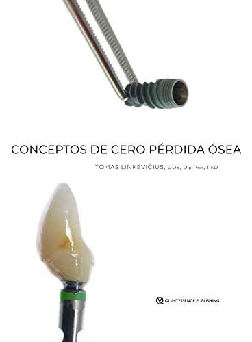 Libro: Conceptos De Cero Perdida Osea (spanish Edition)