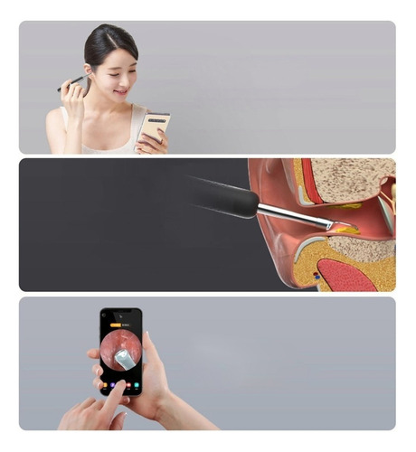 Remoção De Cera Sem Fio Smart Vision Ear Cleaner Otoscope
