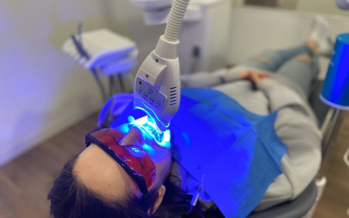 Imagen 9 de 10 de Blanqueamiento Dental Laser