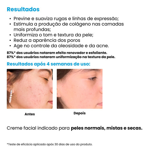 Creamy Skincare Ácido Glicólico 30g | Reduz Poros Dilatados, Melhora A Pele, Hidratação Profunda E Intensa, Controla O Brilho Excessivo | Todos Os Tipos De Pele, Noturno