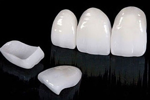 Dentista - Prótesis Dentales - Implantes - Extracciones
