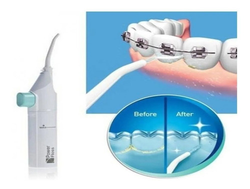 Imagem 3 de 4 de Irrigador Bucal Power Floss Limpeza Dental
