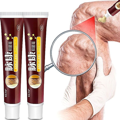 Tratamiento para Tromboflebitis y Trombosis Venosa Profunda Crema