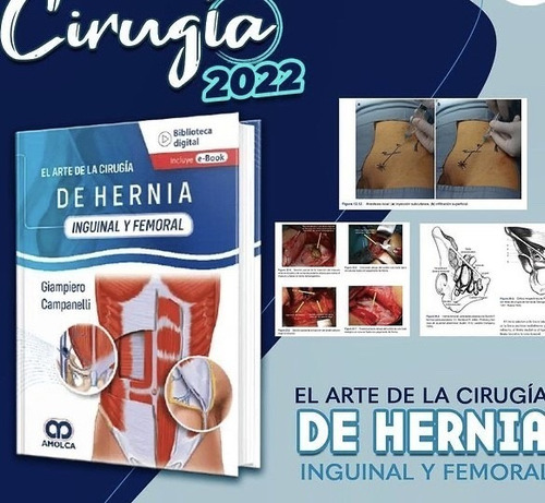 El Arte De La Cirugía De Hernia Inguinal Y Femoral +e-book