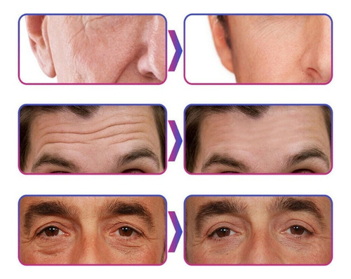 2 Creme Anti Rugas Colágeno Hidrolisado Sinais Profundos 30g