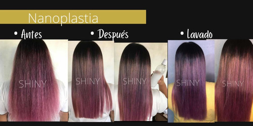 Alaciado Nanoplastia 1l