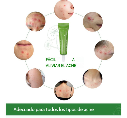 Crema For Eliminar El Acné Centella Asiática Acne Treatment