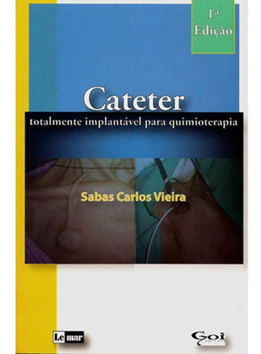 Livro - Cateter - Totalmente Implantável Para Quimioterapia