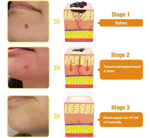 3×crema Veneno Abeja Lipogo, Pomada Veneno Abeja