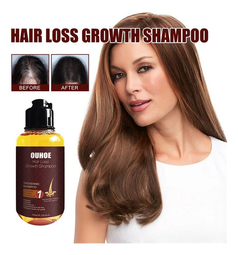 Shampoo Para Cabelo Shampoo Para Espessamento De Cabelo Sham