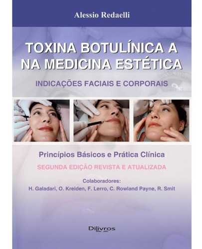 Toxina Botulinica A Na Medicina Estetica - Indicações Faciai