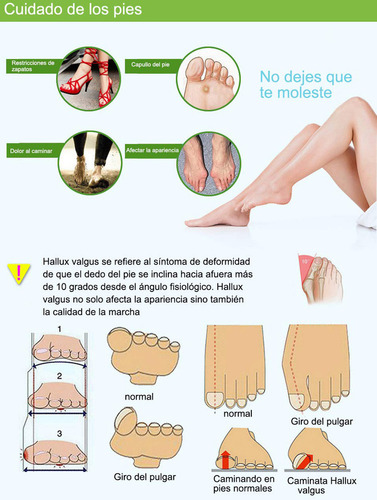 Talas De Correção De Joanete Simples Com Pivô Ajustável