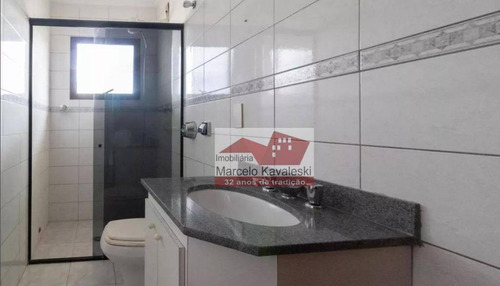 Imagem 10 de 20 de Sobrado À Venda, 141 M² Por R$ 790.000,00 - Mooca - São Paulo/sp - So3323