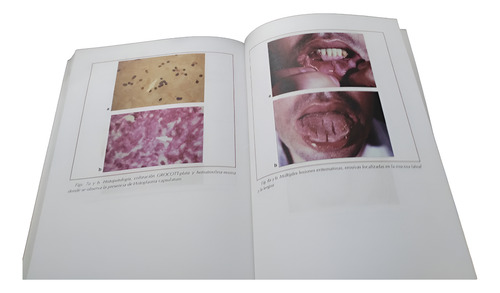 Proami - Medicina Interna Fernando Lasala Ed . Panamericana (Usado)
