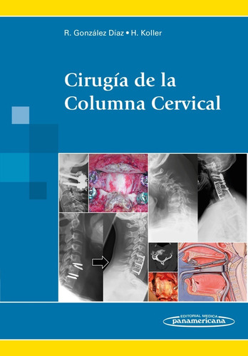 Cirugía De La Columna Cervical Gonzalez