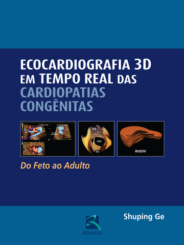 Ecocardiografia 3D em Tempo Real das Cardiopatias Congênitas, de Ge, Shuping. Editorial Thieme Revinter Publicações Ltda, capa dura em português, 2015