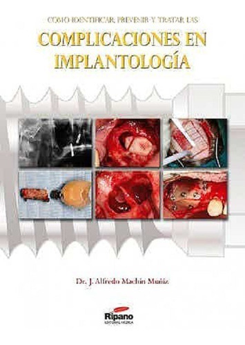 Como Identificar, Prevenir Y Tratar Las Complicaciones En Implantologia, De Muñiz. Editorial Ripano En Español