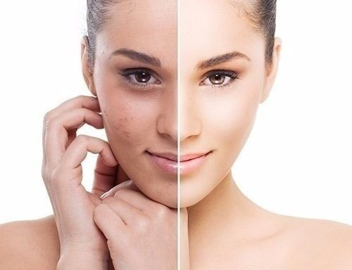 Powder Mask Idraet Máscara Facial En Polvo Vitamin C Todo Tipo De Piel