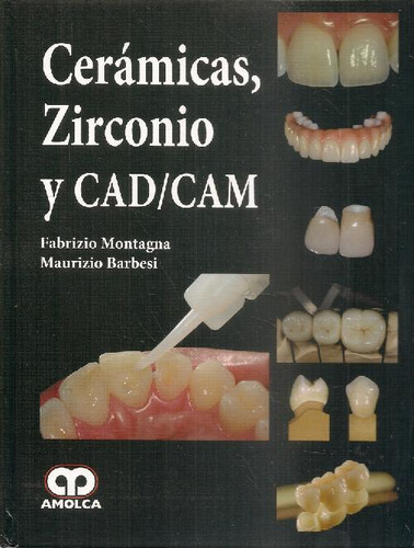 Libro Cerámicas, Zirconio Y Cad/cam De Fabrizio Montagna, Ma