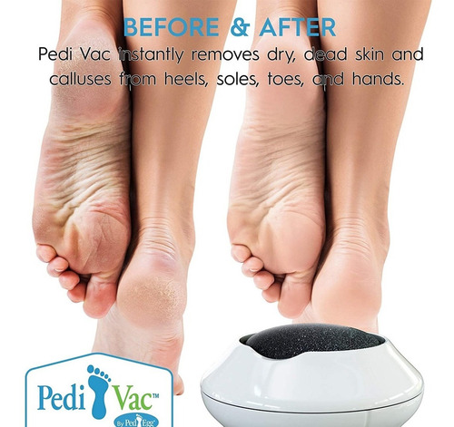 Imagen 9 de 10 de Pedi Spin Pedicura Removedor De Callos Y Piel Seca Para Pies