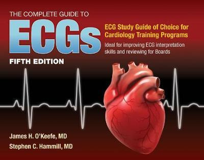 Libro The Complete Guide To Ecgs: A Comprehensive Study G...