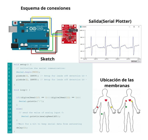 Ad8232 Kit Sensor Pulso Ritmo Cardíaco Módulo Ecg