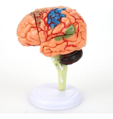 Modelo Cerebro Rompecabezas Cabeza Humano
