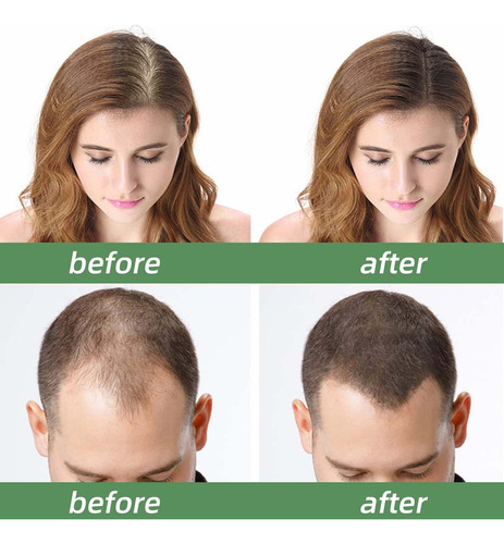 El Aceite De Batana For La Salud Del Cabello Promueve El Bi