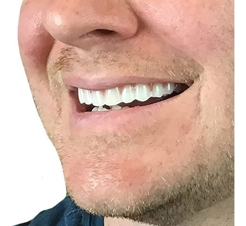 2 Set De Prótesis Profesionales De Silicona Brillante Dentes