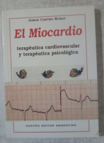 El Miocardio                   Jorge Castro Kubat  